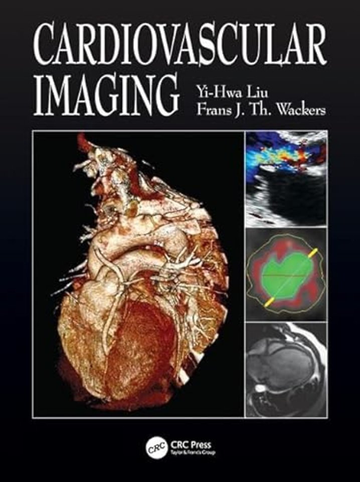 Cardiovascular Imaging
