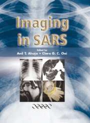 Imaging in SARS