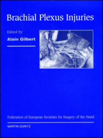 Brachial Plexus Injuries