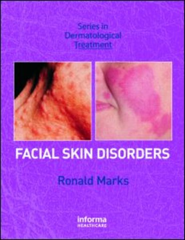 Facial Skin Disorders