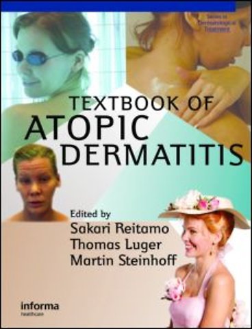 Textbook of Atopic Dermatitis