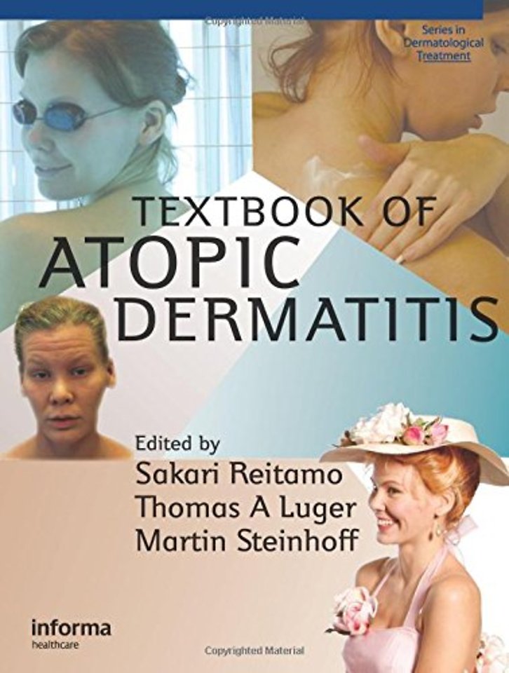 Textbook of Atopic Dermatitis