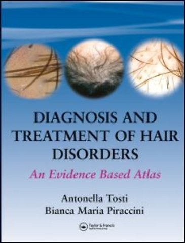Diagnosis and Treatment of Hair Disorders
