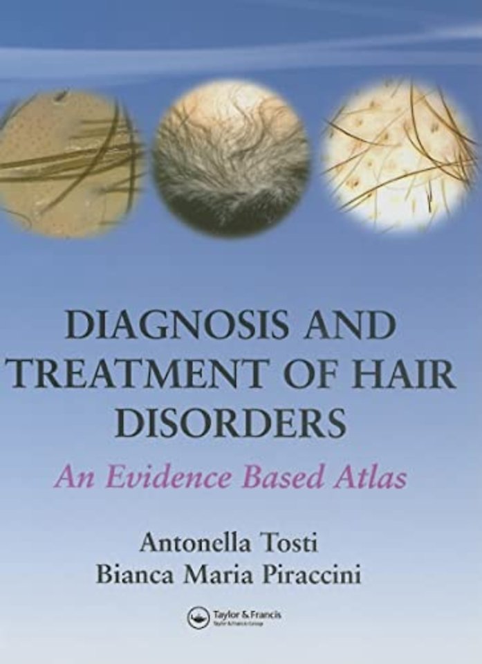 Diagnosis and Treatment of Hair Disorders