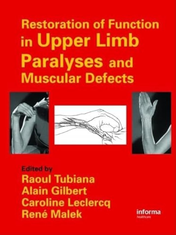 Restoration of Function in Upper Limb Paralyses and Muscular Defects