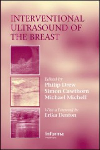 Interventional Ultrasound of the Breast