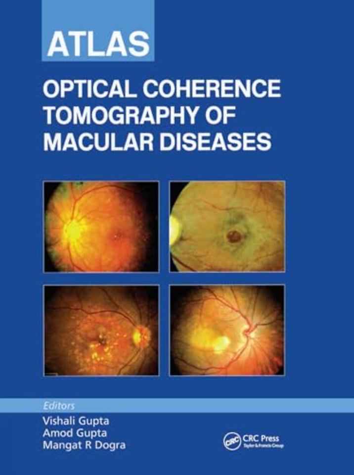 Atlas of Optical Coherence Tomography of Macular Diseases