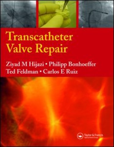 Transcatheter Valve Repair