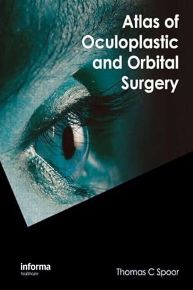 Atlas of Oculoplastic and Orbital Surgery