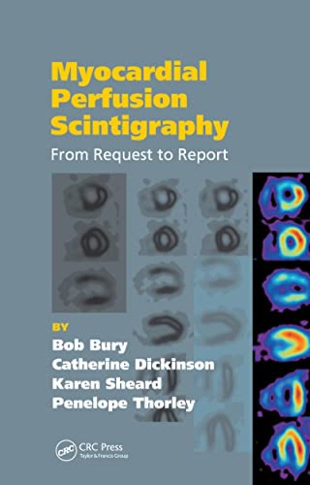 Myocardial Perfusion Scintigraphy