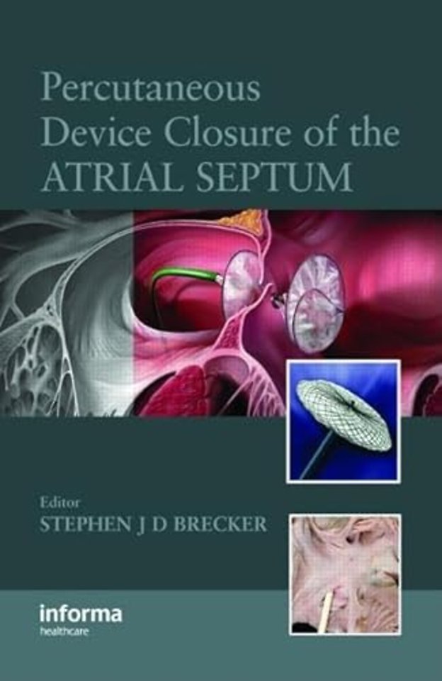 Percutaneous Device Closure of the Atrial Septum