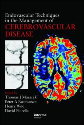 Endovascular Techniques in the Management of Cerebrovascular Disease