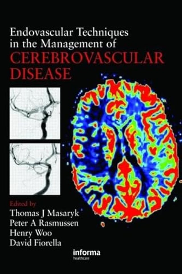 Endovascular Techniques in the Management of Cerebrovascular Disease