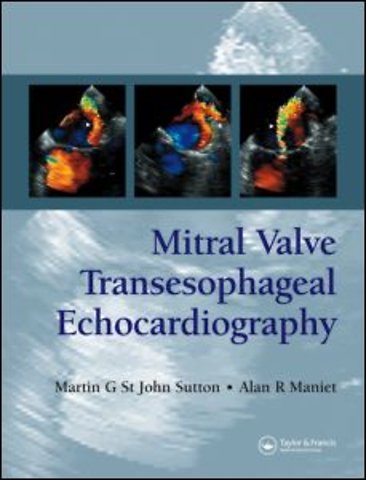 Mitral Valve Transesophageal Echocardiography
