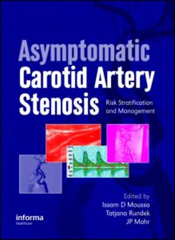 Asymptomatic Carotid Artery Stenosis