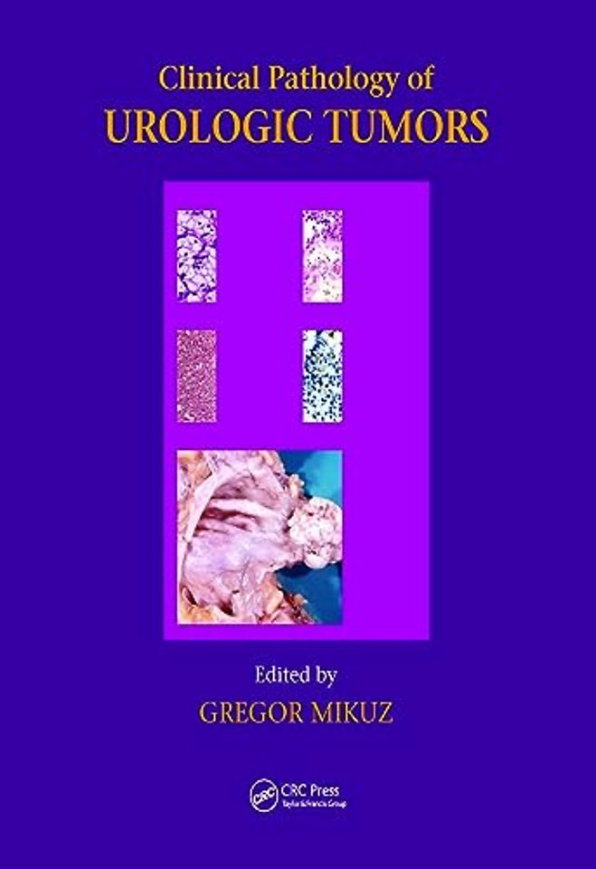Clinical Pathology of Urological Tumours