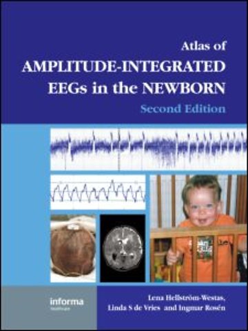 Atlas of Amplitude-Integrated EEGs in the Newborn