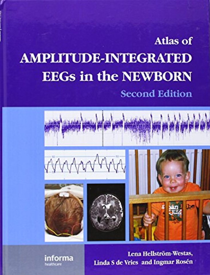 Atlas of Amplitude-Integrated EEGs in the Newborn