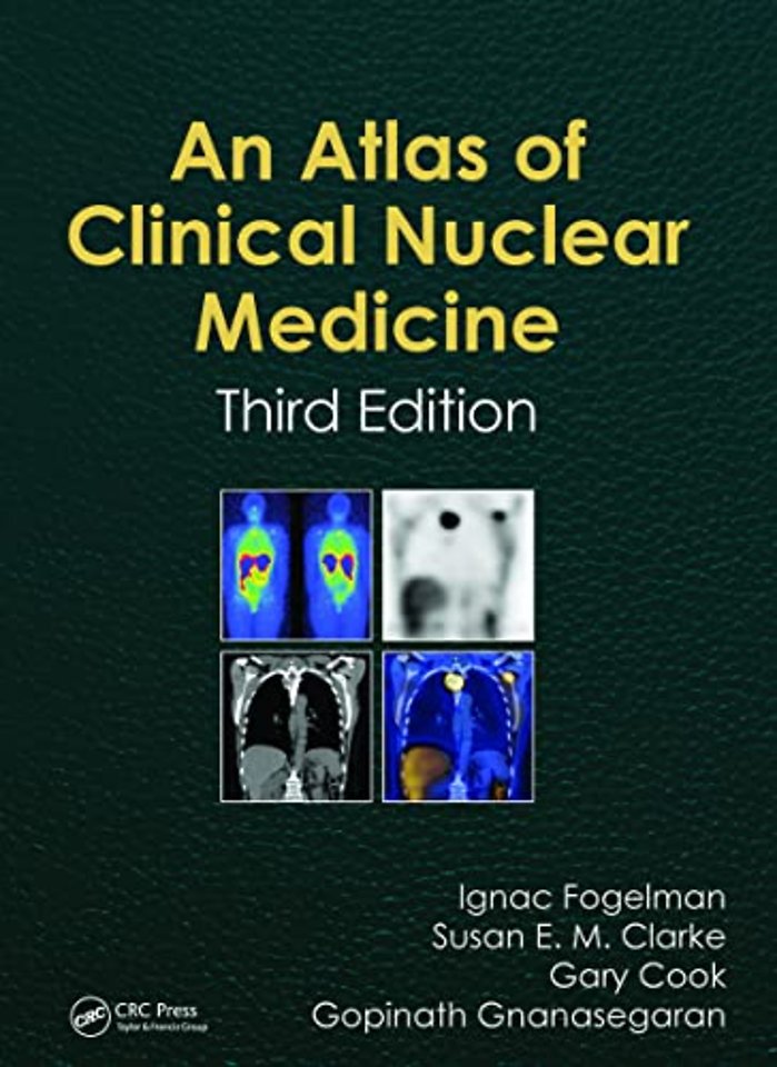 Atlas of Clinical Nuclear Medicine