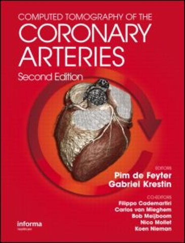 Computed Tomography of the Coronary Arteries