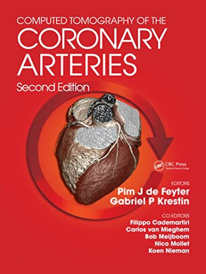 Computed Tomography of the Coronary Arteries