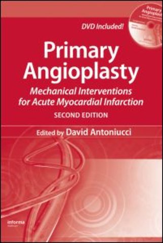 Primary Angioplasty