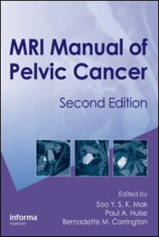 MRI Manual of Pelvic Cancer,Second Edition