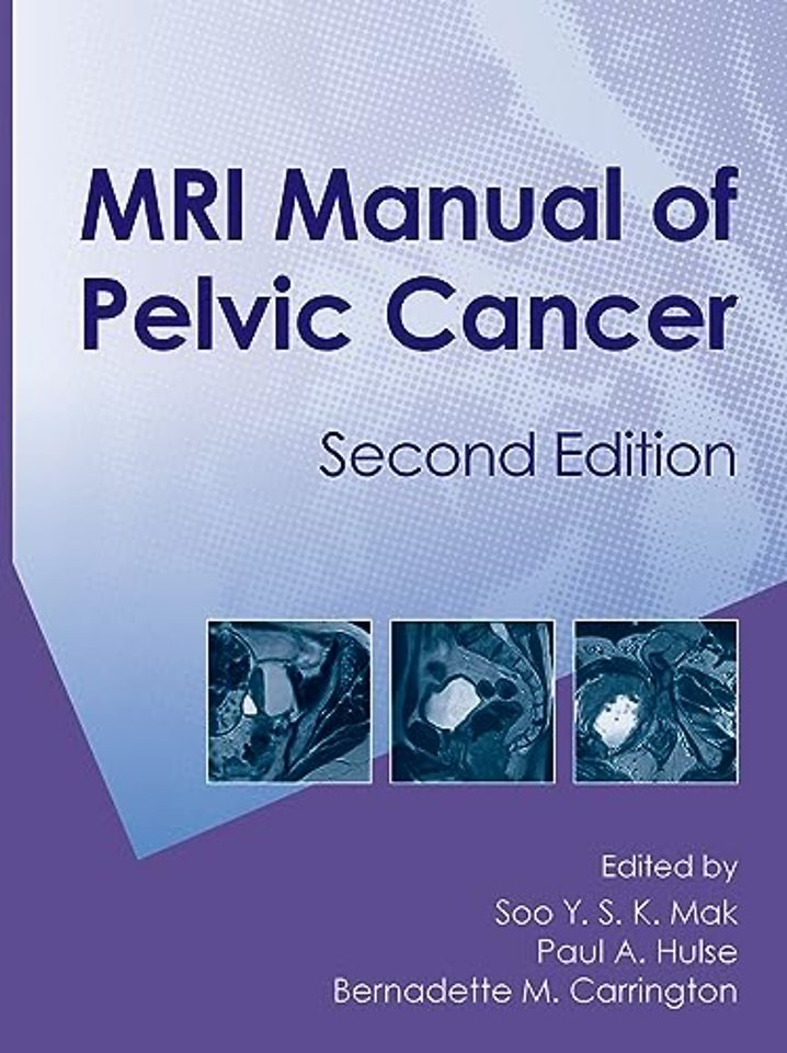 MRI Manual of Pelvic Cancer,Second Edition