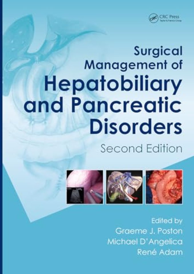 Surgical Management of Hepatobiliary and Pancreatic Disorders, Second Edition