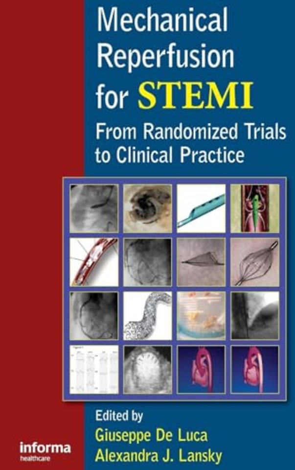 Mechanical Reperfusion for STEMI