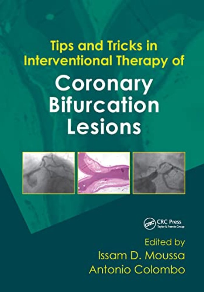 Tips and Tricks in Interventional Therapy of Coronary Bifurcation Lesions