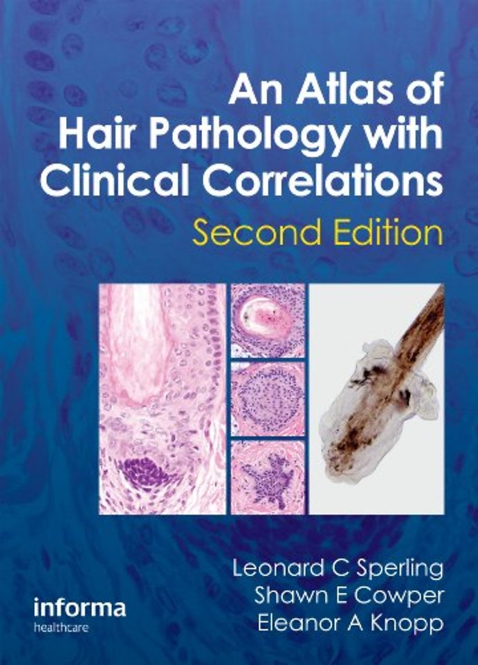Atlas of Hair Pathology with Clinical Correlations