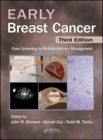 Early Breast Cancer
