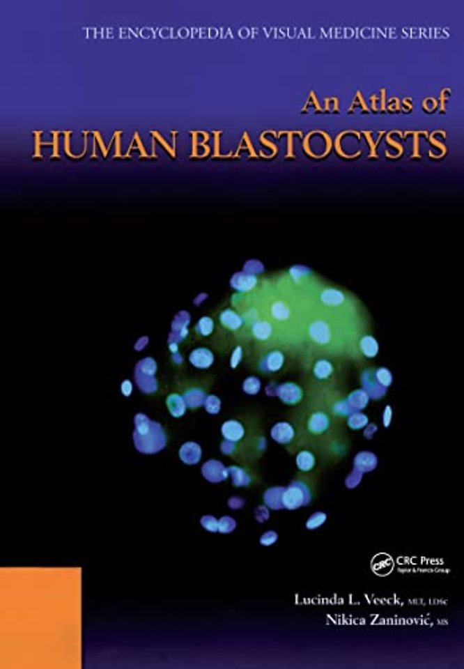 Atlas of Human Blastocysts
