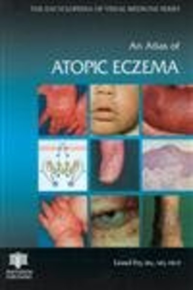 Atlas of Atopic Eczema