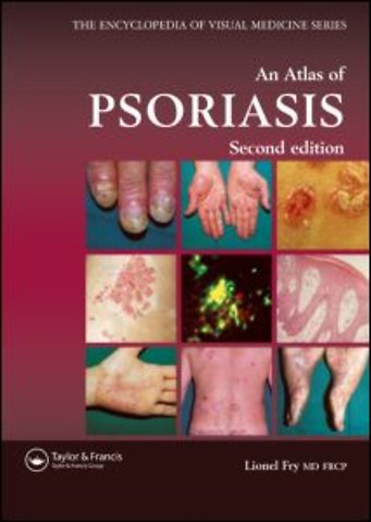 Atlas of Psoriasis, Second Edition