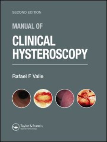Manual of Clinical Hysteroscopy, Second Edition
