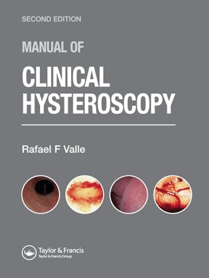 Manual of Clinical Hysteroscopy, Second Edition