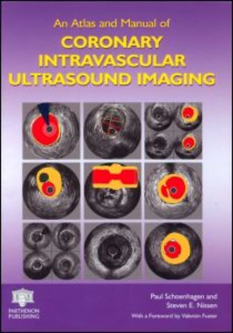 Atlas and Manual of Coronary Intravascular Ultrasound Imaging