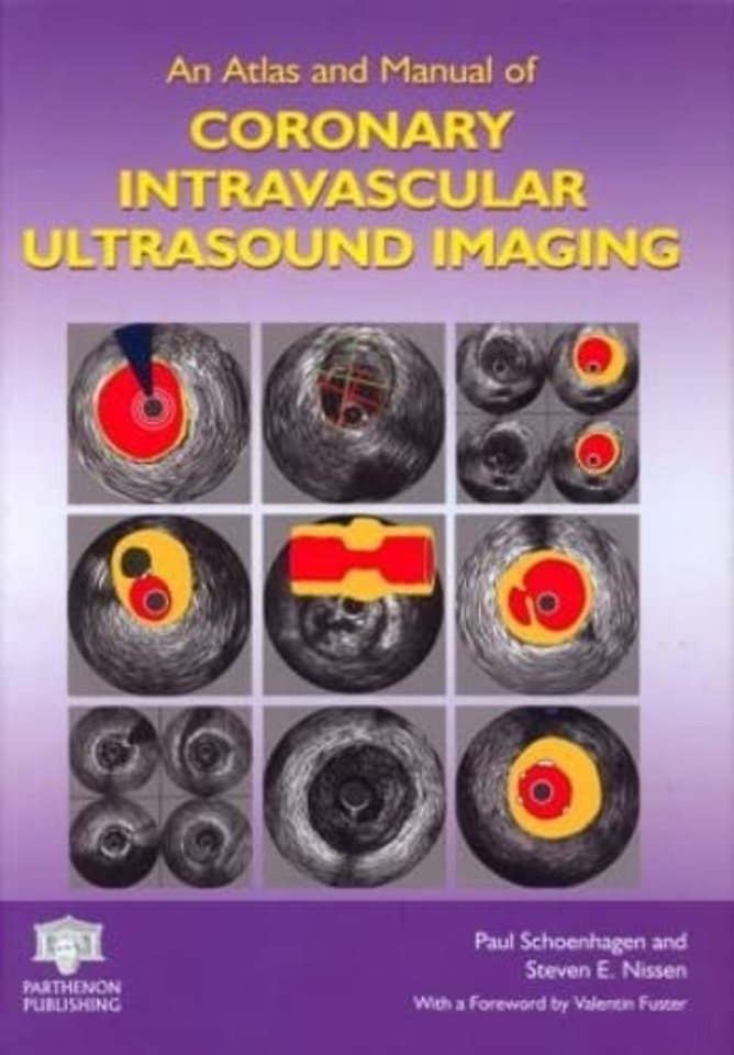 Atlas and Manual of Coronary Intravascular Ultrasound Imaging