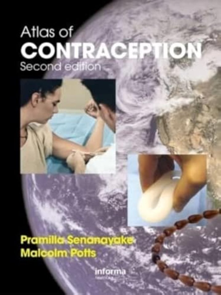 Atlas of Contraception