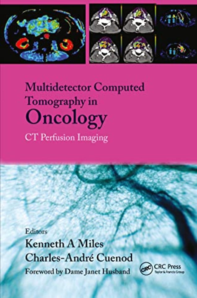 Multi-Detector Computed Tomography in Oncology
