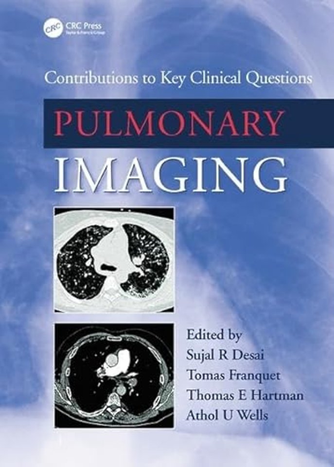 Pulmonary Imaging