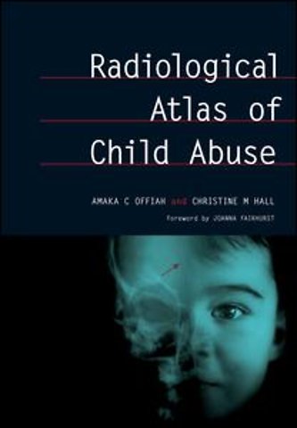 Radiological Atlas of Child Abuse