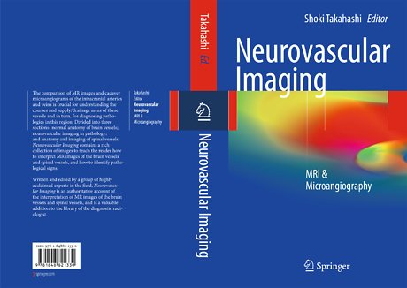 Neurovascular Imaging