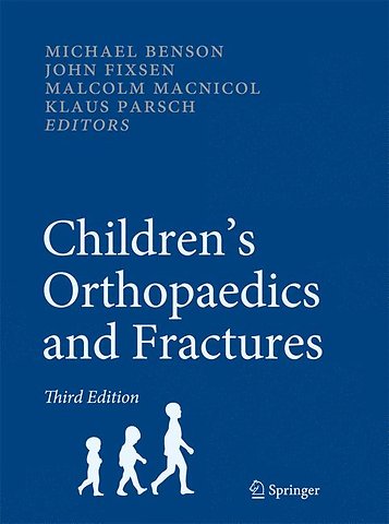 Children’s Orthopaedics and Fractures