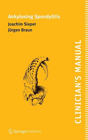 Clinician's Manual on Ankylosing Spondylitis