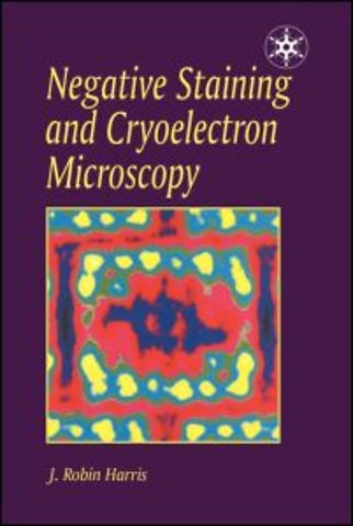 Negative Staining and Cryoelectron Microscopy