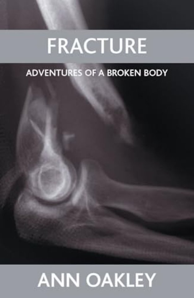 Fracture – Adventures of a broken body