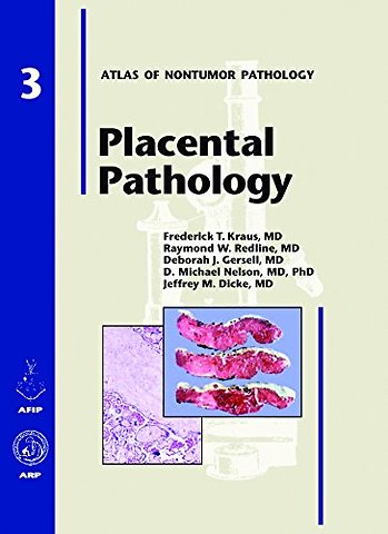 Placental Pathology